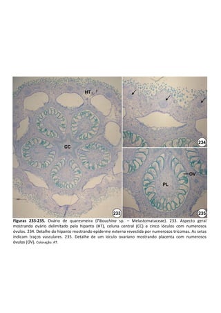 HT




                                                                                                        234
                            CC




                                                                                                   OV

                                                                                    PL




                                                        233                                             235
Figuras  233‐235. Ovário  de  quaresmeira  (Tibouchina sp.  – Melastomataceae).  233.  Aspecto  geral 
mostrando  ovário  delimitado  pelo  hipanto  (HT),  coluna  central  (CC)  e  cinco  lóculos  com  numerosos 
óvulos. 234. Detalhe do hipanto mostrando epiderme externa revestida por numerosos tricomas. As setas 
indicam  traços  vasculares.  235.  Detalhe  de  um  lóculo  ovariano  mostrando  placenta  com  numerosos 
óvulos (OV). Coloração: AT.
 