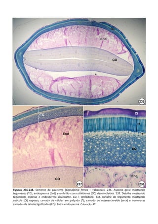TG


                                                                            End




                                                                                      CO




                                                                                                               236



                       TG                                                                                 Ct



                                                                                                             *
                                           End



                                                                                                       EQ




                                                                                                       End
                                    CO
                                                       237                                                     238
Figuras  236‐238. Semente  de  pau‐ferro  (Caesalpinia ferrea – Fabaceae).  236.  Aspecto  geral  mostrando 
tegumento (TG), endosperma (End)  e  embrião  com  cotilédones (CO)  desenvolvidos.  237.  Detalhe  mostrando 
tegumento  espesso  e  endosperma  abundante.  CO  =  cotilédone.  238.  Detalhe  do  tegumento  mostrando 
cutícula  (Ct)  espessa,  camada  de  células  em  paliçada  (*),  camada  de  osteoesclereíde (seta)  e  numerosas 
camadas de células lignificadas (EQ). End = endosperma. Coloração: AT.
 