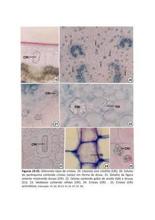 CRi




                            19                                                               20



                    CRi



                                              CRi                                GA




                            21                                                               22




        CRi
                                                                                          CRi

                                                                  CRi


                                 23                                     24                    25
Figuras 19‐25. Diferentes tipos de cristais. 19. Litocisto com cistólito (CRi). 20. Células 
do  parênquima  contendo  cristais  (setas)  em  forma  de  drusa.  21.  Detalhe  da  figura 
anterior  mostrando  drusas  (CRi).  22.  Células  contendo  grãos  de  amido  (GA)  e  drusas 
(Cri).  23.  Idioblasto  contendo  ráfides  (CRi).  24.  Cristais  (CRi)  .  25.  Cristais  (CRi) 
prismáticos. Coloração: 19. Sd; 20‐23. VI, 24. AT, 25. SN.
 