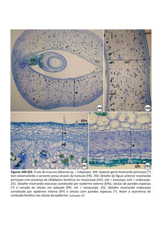 exC




               FN
                                                                                         mC




                                                  *                           enC



                                                                   249                                   250


                                                       EPe



                                         *
                                        PP
                                                                                               *

                                mC
                                                       251                                         EPi   252
Figuras 249‐252. Fruto de mucuna (Mucuna sp. – Fabaceae). 249. Aspecto geral mostrando pericarpo (*) 
bem desenvolvido e semente presa através do funículo (FN). 250. Detalhe da figura anterior mostrando 
pericarpo com presença de idioblastos fenólicos no mesocarpo (mC). exC = exocarpo; enC = endocarpo. 
251. Detalhe mostrando exocarpo constituído por epiderme externa (EPe), células de paredes espessas 
(*)  e  camada  de  células  em  paliçada  (PP).  mC =  mesocarpo.  252.  Detalhe  mostrando  endocarpo 
constituído  por  epiderme  interna  (EPi)  e  células  com  paredes  espessas  (*).  Notar  a  ocorrência  de 
conteúdo fenólico nas células da epiderme. Coloração: AT.
 