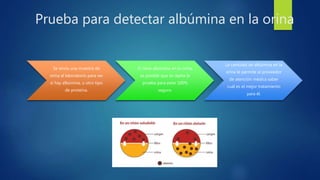 Prueba para detectar albúmina en la orina
Se envía una muestra de
orina al laboratorio para ver
si hay albúmina, u otro tipo
de proteína.
Si tiene albúmina en la orina,
es posible que se repita la
prueba para estar 100%
seguro.
La cantidad de albúmina en la
orina le permite al proveedor
de atención médica saber
cuál es el mejor tratamiento
para él.
 