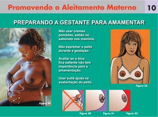 Promovendo o Aleitamento Materno                                        10

 PREPARANDO A GESTANTE PARA AMAMENTAR
                    Não usar cremes,
                    pomadas, sabão ou
                    sabonete nos mamilos.

                    Não espremer o peito
                    durante a gestação.

                    Avaliar se o bico
                    ﬁca saliente não tem
                    importância para a
                    amamentação.

                    Usar sutiã ajuda na
                    sustentação do peito.
                                                                Figura 33




        Figura 29



                                 Figura 30   Figura 31   Figura 32
 