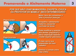 Promovendo o Aleitamento Materno
POR QUE NÃO USAR MAMADEIRA, CHUPETA, CHUCA
OU PROTETOR DE MAMILO (BICO INTERMEDIÁRIO)
Maior risco de contaminar o
leite e provocar doenças.
Atrapalha o aleitamento
materno, causando
confusão de bicos.
Pode modiﬁcar a posição
dos dentes, prejudicar a
fala e respiração fazendo
o bebê respirar pela boca.
É mais caro e sua
preparação dá mais
trabalho.
Diminui o contato entre
mãe e ﬁlho.
3
Pega Correta
Pega incorreta
Figura 3 Figura 4
Figura 5 Figura 6
Figura 7
 