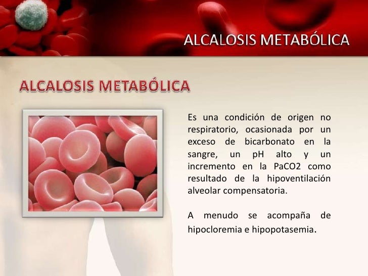 Alcalosis Metabólica Alcalosis Metabólica