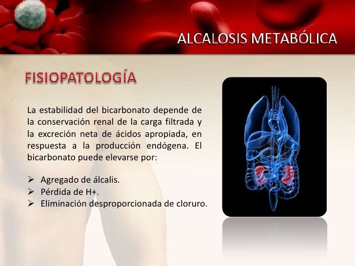 Alcalosis Metabólica Alcalosis Metabólica
