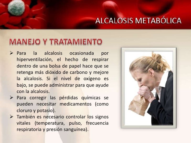 Alcalosis Metabólica Alcalosis Metabólica