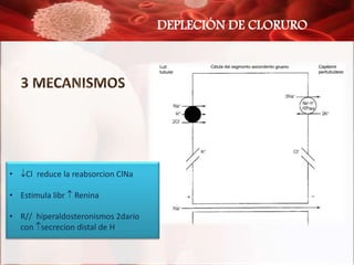 DEPLECIÓN DE CLORURO
• Cl reduce la reabsorcion ClNa
• Estimula libr  Renina
• R// hiperaldosteronismos 2dario
con secr...