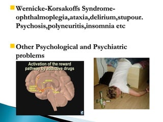 Wernicke-Korsakoffs Syndrome- ophthalmoplegia,ataxia,delirium,stupour. Psychosis,polyneuritis,insomnia etc Other Psychological and Psychiatric problems 