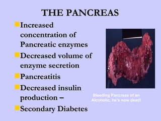THE PANCREAS Increased concentration of Pancreatic enzymes Decreased volume of enzyme secretion Pancreatitis Decreased insulin production – Secondary Diabetes Bleeding Pancreas of an Alcoholic, he’s now dead! 