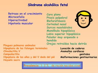 Síndrome alcohólico fetal Retraso en el crecimiento Microcefalia Hiperactividad Hipotonía muscular Cara plana Ptosis palpebral Blefarofimosis Cortedad nasal Surcos nasolabiales Mandíbula hipoplásica Labio superior hipoplásico Paladar muy arqueado o hendido Orejas retraídas hacia detrás Pliegues palmares anómalos Hipoplasia de las falanges terminales Clinodactilia V Campodactilia Hipoplasia de las uñas y del V dedo del pié Hoyuelo sacro Luxación de caderas Anomalías cardíacas “  genitales Malformaciones genitourinarias Prevalencia:   1- 2 %   de recién nacidos vivos 