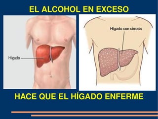 EL ALCOHOL EN EXCESO




HACE QUE EL HÍGADO ENFERME
 