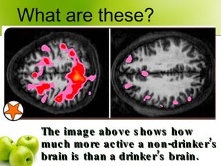 The image above shows how much more active a non-drinker’s brain is than a drinker’s brain. ,[object Object]