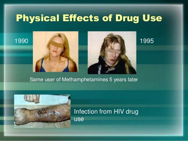 Alcohol Withdrawal Medlineplus Medical Encyclopedia Alcohol Withdrawal Medlineplus Medical Encyclopedia