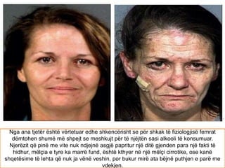 Nga ana tjetër është vërtetuar edhe shkencërisht se për shkak të fiziologjisë femrat
dëmtohen shumë më shpejt se meshkujt për të njëjtën sasi alkooli të konsumuar.
Njerëzit që pinë me vite nuk ndjejnë asgjë papritur një ditë gjenden para një fakti të
hidhur, mëlçia e tyre ka marrë fund, është kthyer në një mëlçi cirrotike, ose kanë
shqetësime të lehta që nuk ja vënë veshin, por bukur mirë ata bëjnë puthjen e parë me
vdekjen.
 