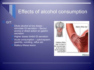 Effects of alcohol consumption
 GIT:
 Dilute alcohol at low doses -
stimulate GI secretion – flavour,
aroma or direct action on gastrin
secretion
 Higher doses inhibit GI secretion
 Acute consumption – pylorospasm,
gastritis, vomiting, reflux etc
 Mallory-Weiss lesion
 