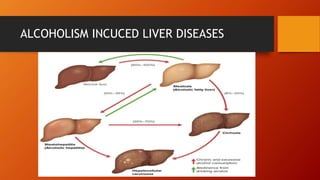 ALCOHOLISM INCUCED LIVER DISEASES
 