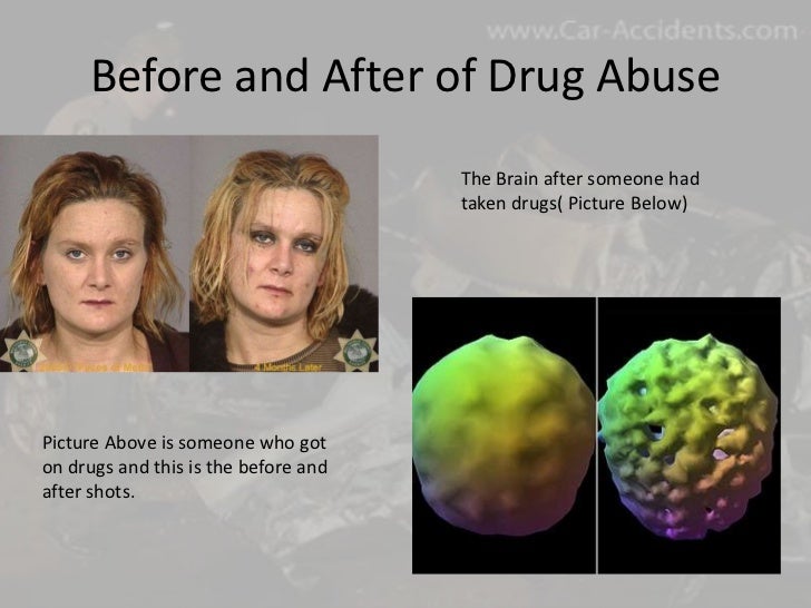 Alcohol and drugs powerpoint