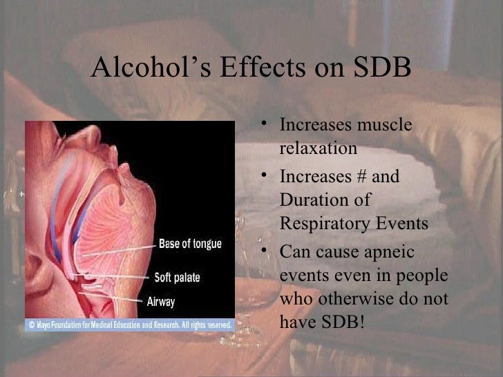 Alcohol And Sleep Apnea