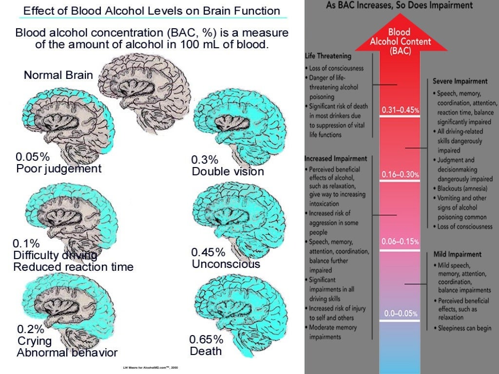 alcoholic-brain