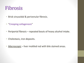 Fibrosis
• Brisk sinusoidal & perivenular fibrosis.
• “Creeping collagenosis”
• Periportal fibrosis – repeated bouts of heavy alcohol intake.
• Cholestasis, iron deposits.
• Macroscopic – liver mottled red with bile stained areas.
 