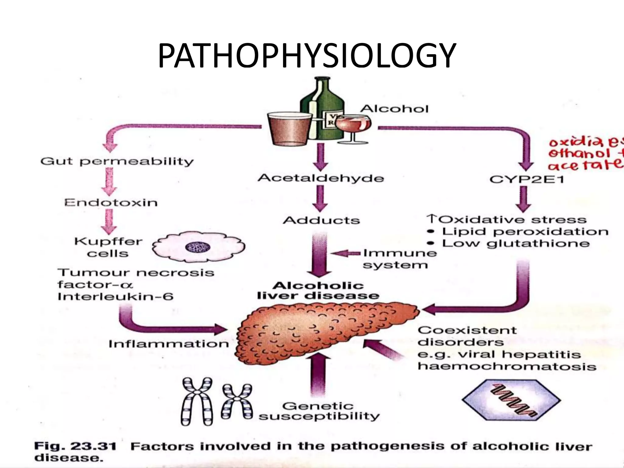 Alcoholic hepatitis | PPTX