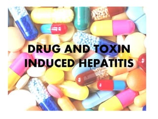 DRUG AND TOXIN
INDUCED HEPATITIS
 