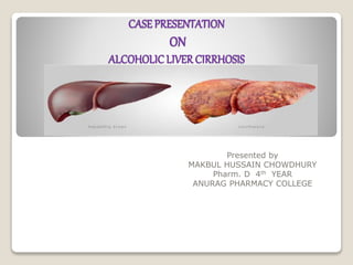 CASE PRESENTATION
ON
ALCOHOLICLIVER CIRRHOSIS
Presented by
MAKBUL HUSSAIN CHOWDHURY
Pharm. D 4th YEAR
ANURAG PHARMACY COLLEGE
 