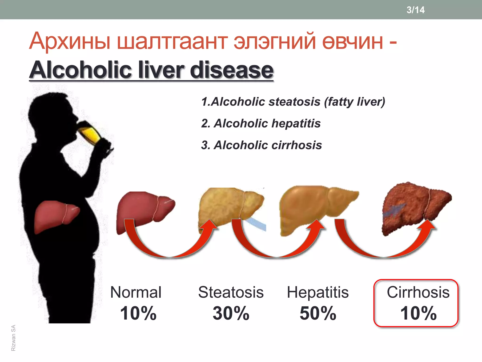 Alcoholism visual data 8