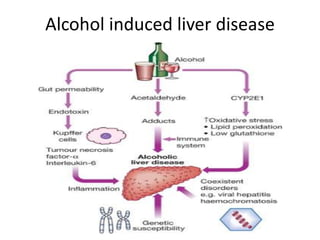 Alcohol induced liver disease
 