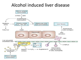 Alcohol induced liver disease
 