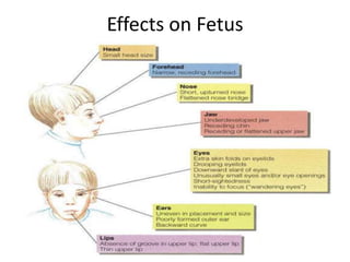 Effects on Fetus
 