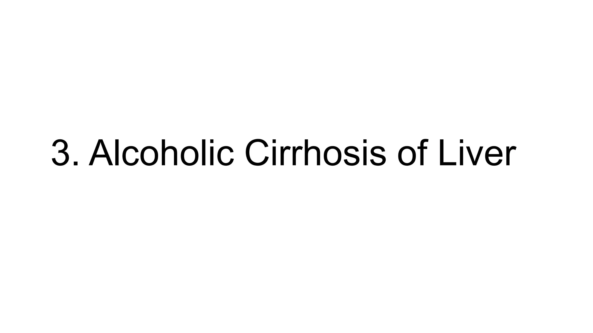 3. Alcoholic Cirrhosis of Liver