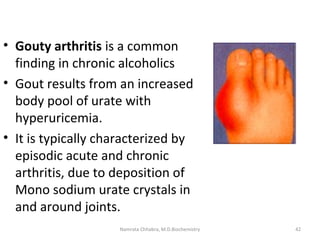 • Gouty arthritis is a common
finding in chronic alcoholics
• Gout results from an increased
body pool of urate with
hyperuricemia.
• It is typically characterized by
episodic acute and chronic
arthritis, due to deposition of
Mono sodium urate crystals in
and around joints.
42Namrata Chhabra, M.D.Biochemistry
 