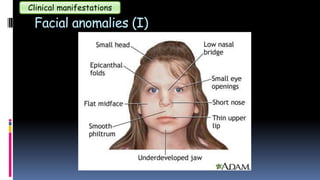 Facial anomalies (I)
Clinical manifestations
 