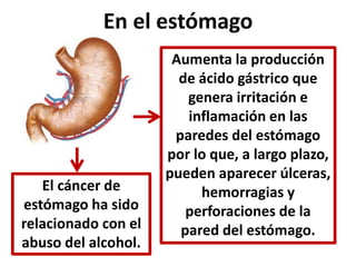 En el estómago 
El cáncer de 
estómago ha sido 
relacionado con el 
abuso del alcohol. 
Aumenta la producción 
de ácido gástrico que 
genera irritación e 
inflamación en las 
paredes del estómago 
por lo que, a largo plazo, 
pueden aparecer úlceras, 
hemorragias y 
perforaciones de la 
pared del estómago. 
 