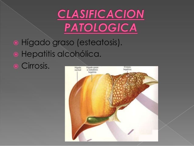 Donde es posible ser codificado del alcoholismo orenburge