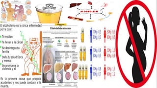 Alcoholismo 