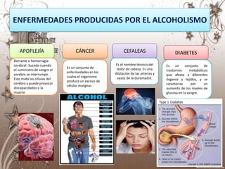 ENFERMEDADES PRODUCIDAS POR EL ALCOHOLISMO


   APOPLEJÍA                      CÁNCER                  CEFALEAS                      DIABETES
Derrame o hemorragia
cerebral.-Sucede cuando                              Es el nombre técnico del      Es un conjunto de
                             Es un conjunto de       dolor de cabeza. Es una
el suministro de sangre al                                                         trastornos     metabólicos
                             enfermedades en las    dilatación de las arterias y
cerebro se interrumpe.                                                             que afecta a diferentes
                             cuales el organismo      vasos de la duramadre.
Esto mata las células del                                                          órganos y tejidos, y se
                             produce un exceso de
cerebro y puede provocar                                                           caracteriza     por     un
                             células malignas
discapacidades o la                                                                aumento de los niveles de
muerte                                                                             glucosa en la sangre.
 