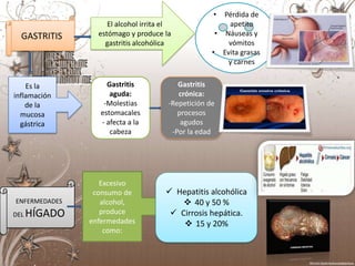 •  Pérdida de
                    El alcohol irrita el                apetito
  GASTRITIS      estómago y produce la               • Náuseas y
                   gastritis alcohólica                 vómitos
                                                    • Evita grasas
                                                        y carnes


    Es la           Gastritis             Gastritis
inflamación          aguda:               crónica:
    de la          -Molestias          -Repetición de
  mucosa          estomacales             procesos
  gástrica        - afecta a la            agudos
                     cabeza             -Por la edad




                  Excesivo
                consumo de             Hepatitis alcohólica
ENFERMEDADES      alcohol,                 40 y 50 %
DEL   HÍGADO      produce               Cirrosis hepática.
               enfermedades                15 y 20%
                   como:
 