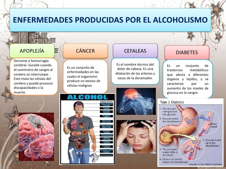 Ha dejado a beber cerveza y ha adelgazado