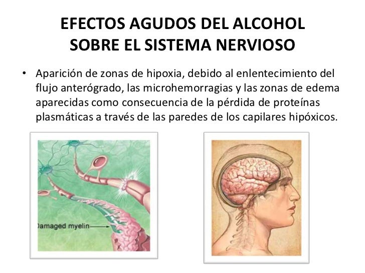 La clínica de la dependencia alcohólica rostov
