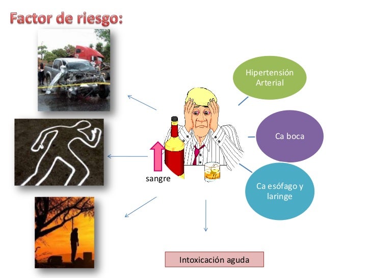 Ser codificado del alcohol en petrozavodsk