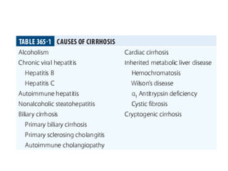Alcohol liver disease : causes , pathophysiology and its management | PPTX
