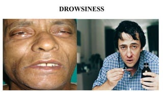 DROWSINESS