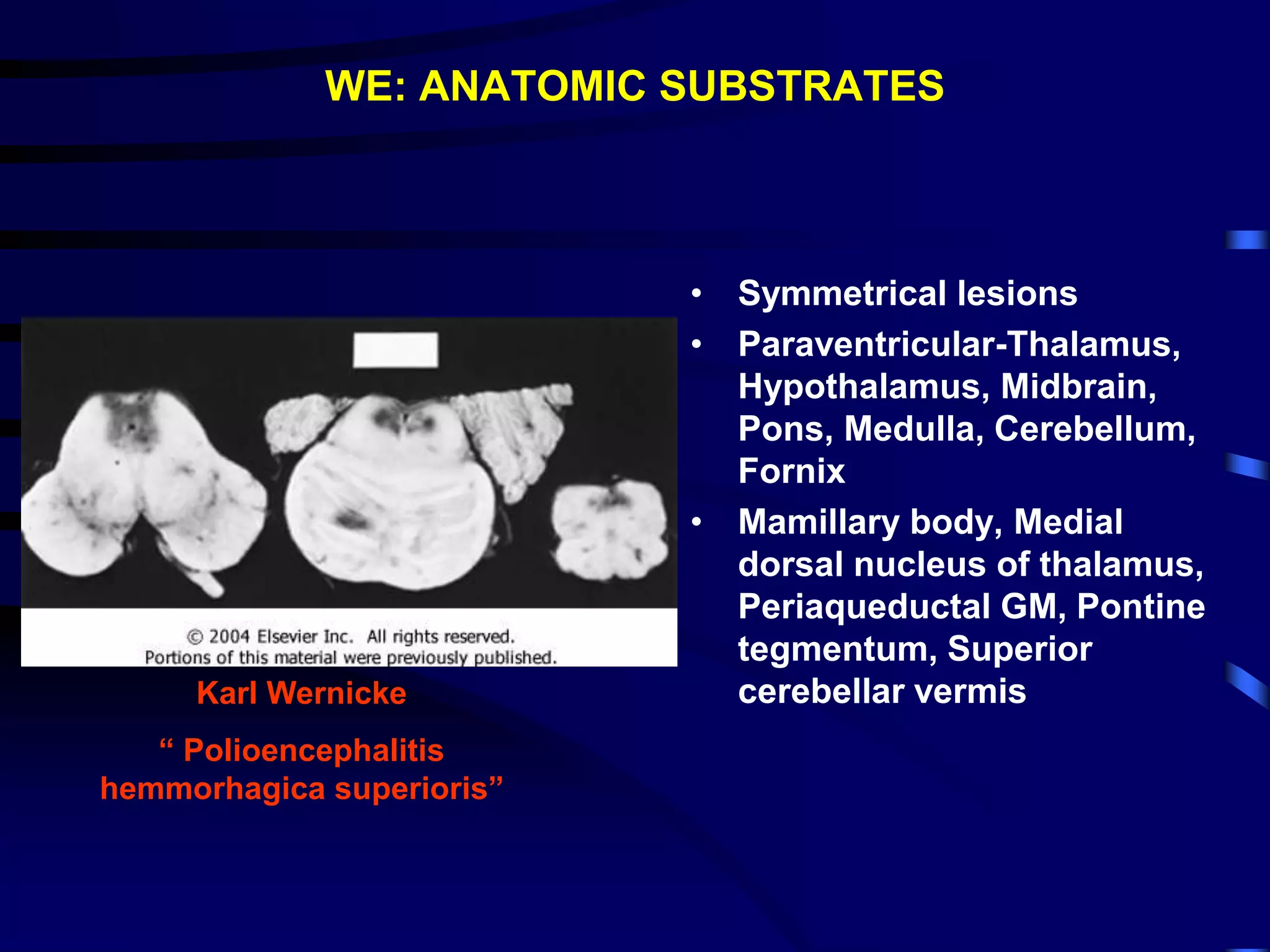 WE: ANATOMIC SUBSTRATES
• Symmetrical lesions
• Paraventricular-Thalamus,
Hypothalamus, Midbrain,
Pons, Medulla, Cerebellum,
Fornix
• Mamillary body, Medial
dorsal nucleus of thalamus,
Periaqueductal GM, Pontine
tegmentum, Superior
cerebellar vermis
Karl Wernicke
“ Polioencephalitis
hemmorhagica superioris”
 