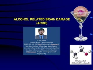 ALCOHOL RELATED BRAIN DAMAGE
(ARBD)
 