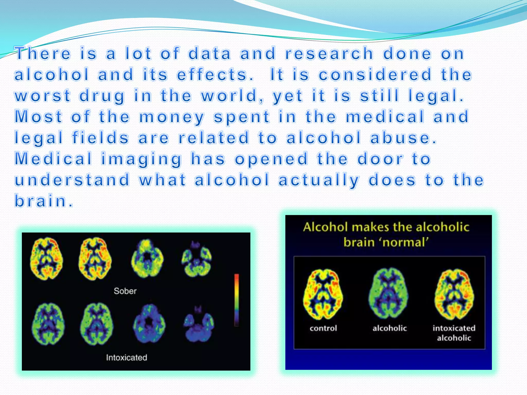 Alcohol’S Effects On The Brain | PPTX