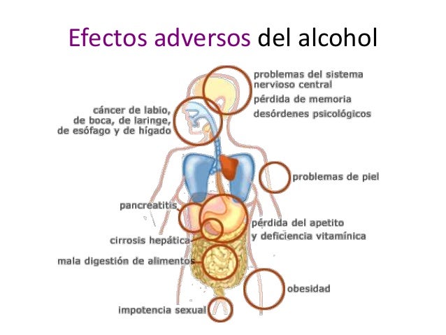 En funciona cuánto la codificación del alcohol