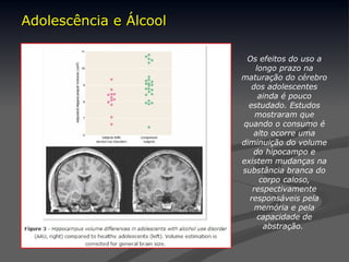 Adolescência e Álcool
Adolescência e Álcool
Os efeitos do uso a
longo prazo na
maturação do cérebro
dos adolescentes
ainda é pouco
estudado. Estudos
mostraram que
quando o consumo é
alto ocorre uma
diminuição do volume
do hipocampo e
existem mudanças na
substância branca do
corpo caloso,
respectivamente
responsáveis pela
memória e pela
capacidade de
abstração.
 