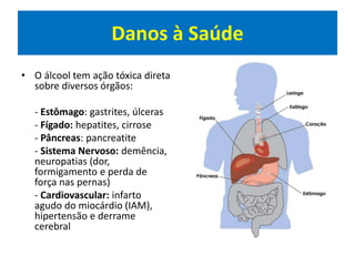 Danos à Saúde
• O álcool tem ação tóxica direta
sobre diversos órgãos:
- Estômago: gastrites, úlceras
- Fígado: hepatites, cirrose
- Pâncreas: pancreatite
- Sistema Nervoso: demência,
neuropatias (dor,
formigamento e perda de
força nas pernas)
- Cardiovascular: infarto
agudo do miocárdio (IAM),
hipertensão e derrame
cerebral
 